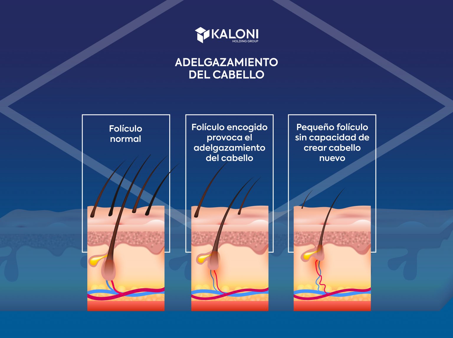 Por Qu Se Adelgaza El Cabello Razones Y Soluciones Kaloni Hair