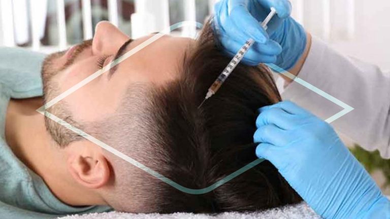 ¿Qué es la mesoterapia capilar hair filler?