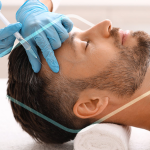 Hombre recibiendo tratamiento de mesoterapia capilar con finasteride