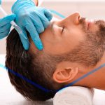 Hombre recibiendo tratamiento de mesoterapia capilar