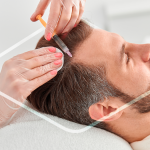 Paciente recibiendo mesoterapia capilar que se inyecta