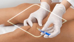 acido hialuronico rodilla