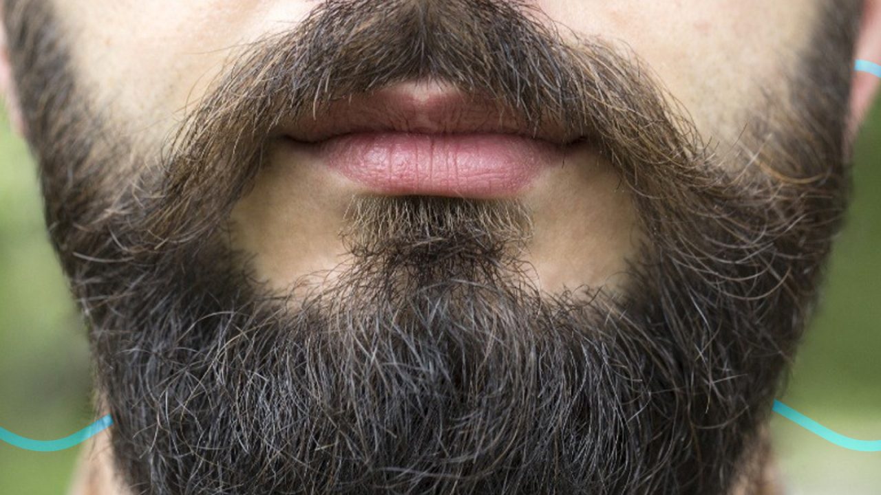 Conviene hacerse un injerto de barba y bigote Kaloni M xico