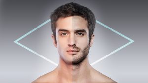 Injerto de barba antes y después