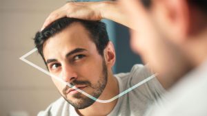 Alopecia