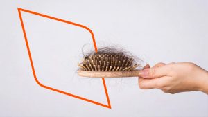 Conoce la alopecia con fotos