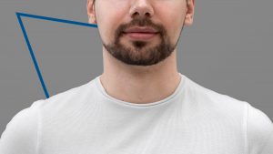 trasplante de barba