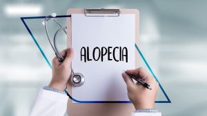 alopecia