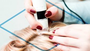 Trasplante de Cabello en Mujeres