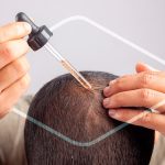 Minoxidil farmacias similares