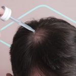 ¿Cuáles son las instrucciones del minoxidil?