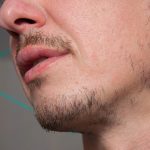 ¿Qué tan bueno es el minoxidil para la barba?
