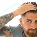 Cuáles son las diferencias entre el minoxidil vs nanoxidil