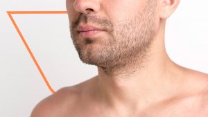 efectos secundarios del minoxidil en barba