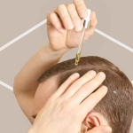 donde venden minoxidil