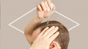 donde venden minoxidil
