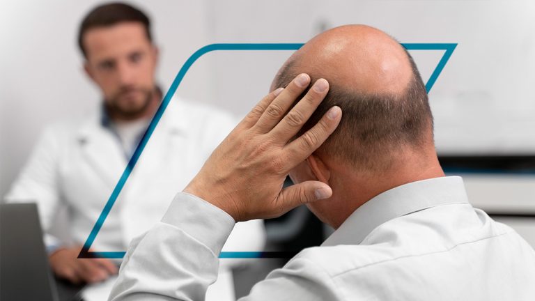 ¿El minoxidil causa dolor de cabeza?