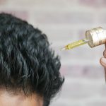 cuanto cuesta el minoxidil