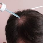 cuanto cuesta minoxidil 5 en mexico