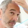 Grados de alopecia: conoce su
  clasificación y manejo