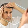 Estas son las enfermedades que cusan la caída del cabello