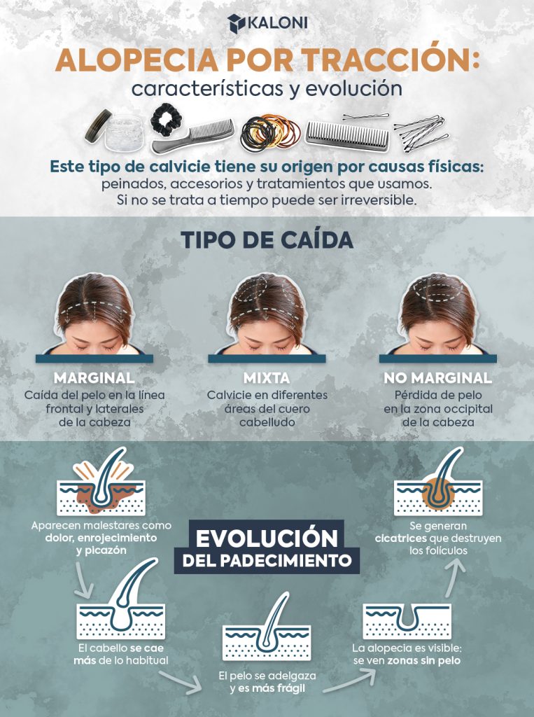 infografia-alopecia-traccional