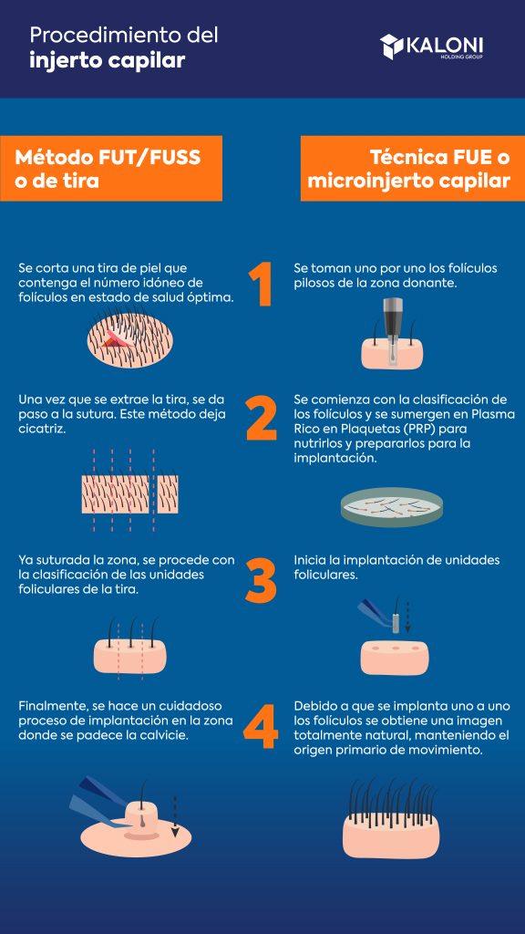 Trasplante capilar técnica FUE vs técnica FUT