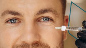 Lifting facial sin cirugía, ¿funciona?