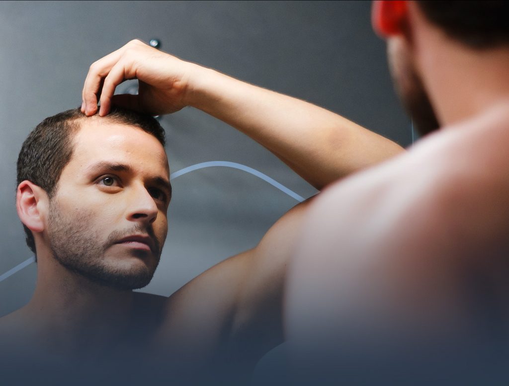 Escala-Hamilton-Norwood-res