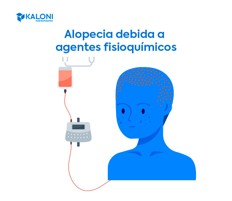 Alopecia por agentes fisioquímicos