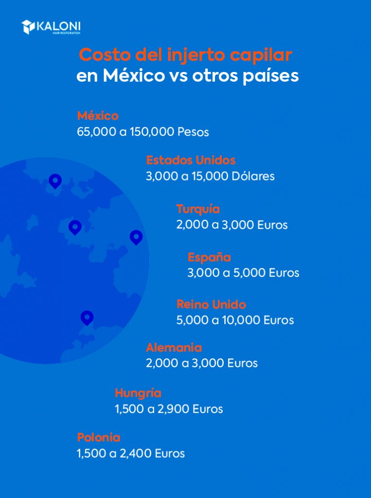 Costo del injerto capilar en México