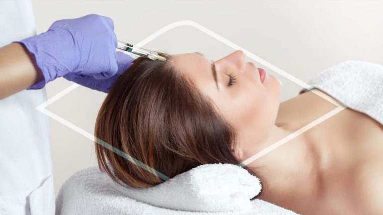 Mesoterapia capilar femenina: la solución ideal para que vuelva a crecer el cabello