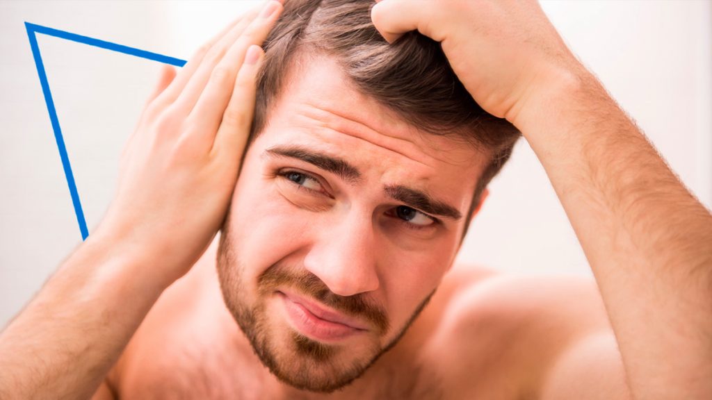 Tratamiento para la alopecia