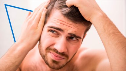 Tratamiento para la alopecia