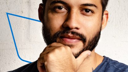 minoxidil barba