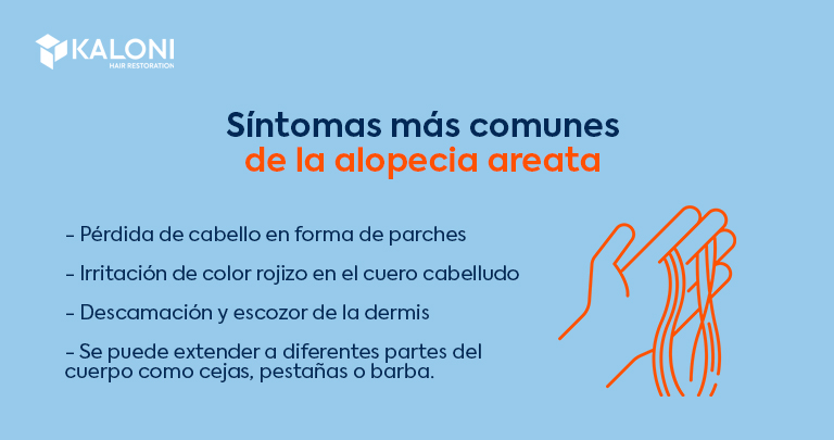 ¿Cuáles son los síntomas de la alopecia areata?