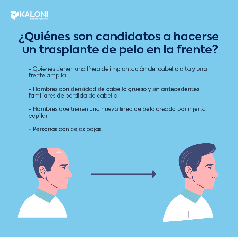 ¿A quién le beneficia el trasplante de cabello en la frente?