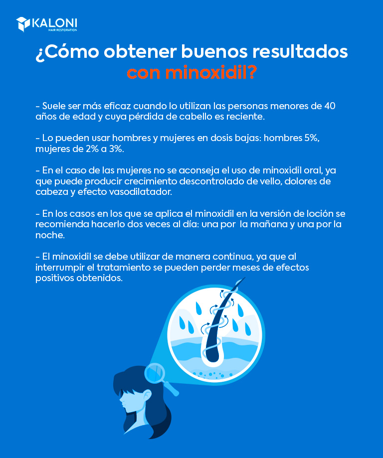 ¿Cómo obtener buenos resultados con minoxidil?