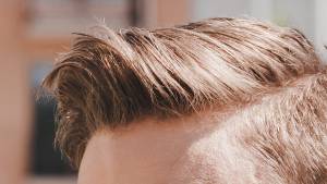 implantes de cabello para hombres